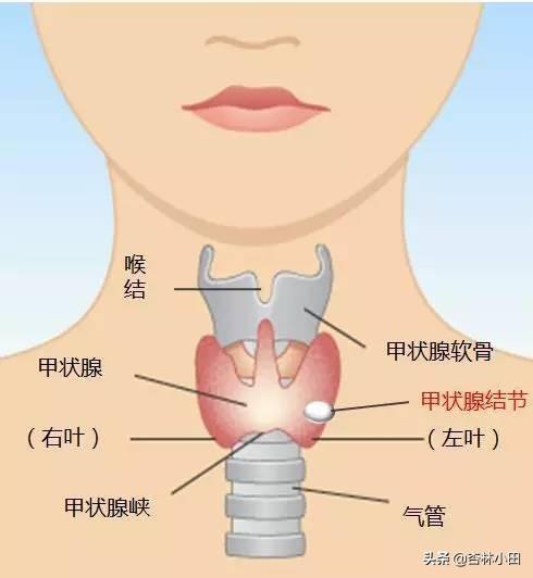 甲狀腺結(jié)節(jié)貼吧最新資訊與討論匯總