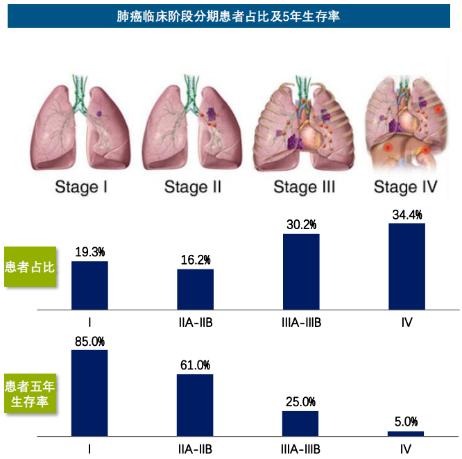 肺癌最新研究進(jìn)展，突破瓶頸，迎來治療新希望